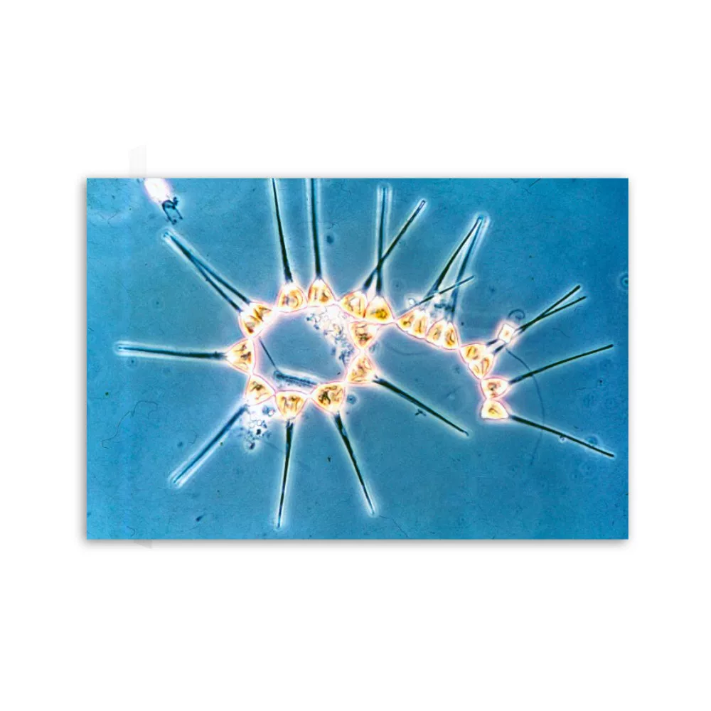 Motiv: Asterionella japonica (Leinwand 90x60 cm)
