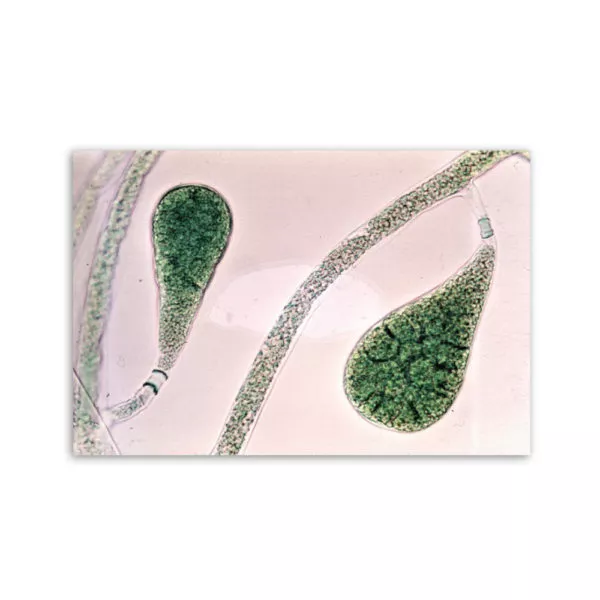 Motiv: Bryopsidella neglecta (Leinwand 90x60 cm)