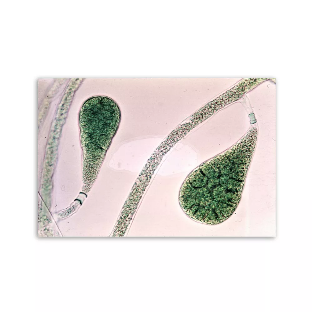 Motiv: Bryopsidella neglecta (Leinwand 90x60 cm)