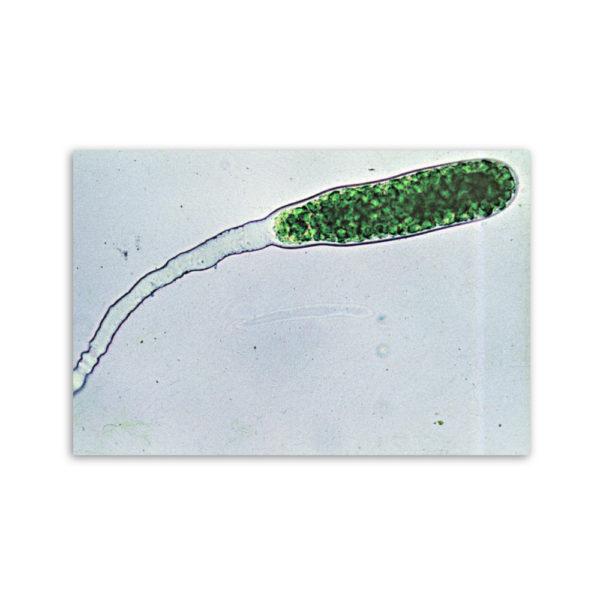 Motiv: Codiolum spp (Leinwand 90x60 cm)