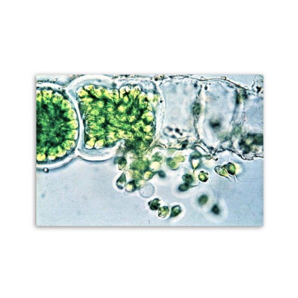 Motiv: Ulothrix spp (Leinwand 90x60 cm)